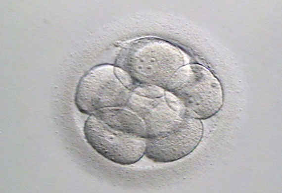 Best IVF Centre in Delhi NCR with High Success Rates